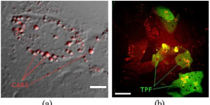 Fig. 3. Generalized CARS microscopy optical setup. The pump laser is split using a beam splitter (BS)