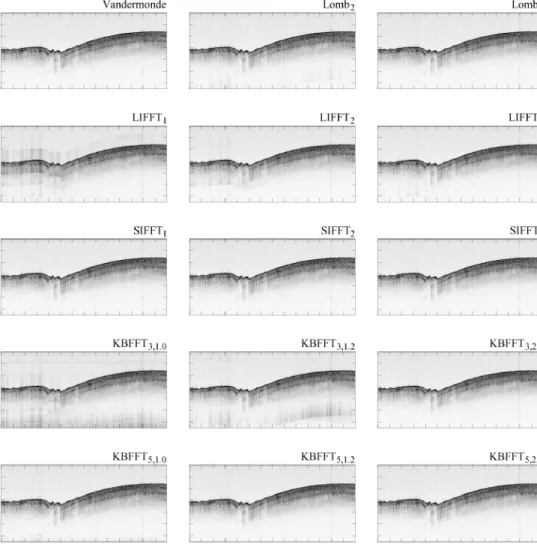 Fig. 7. OCT images of a finger nail of a healthy volunteer using different signal processing  methods
