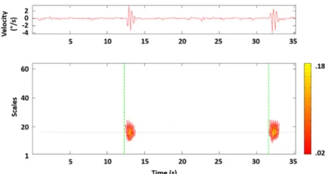 Fig. 2 Example of stroop task response detection based on energy percentage of each wavelet coefficient