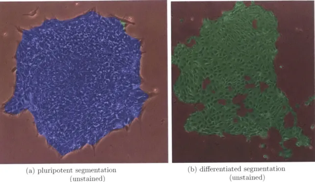 Figure  1-4:  Stem cell  colony segmentation. pluripotent  (a)  and  differentiated  (b)  colonies  segmented and  classified  as  in  chapter  6:  blue  regions  were  classified  pluripotent,  green  differentiated,  and  red media:  image  colorization 