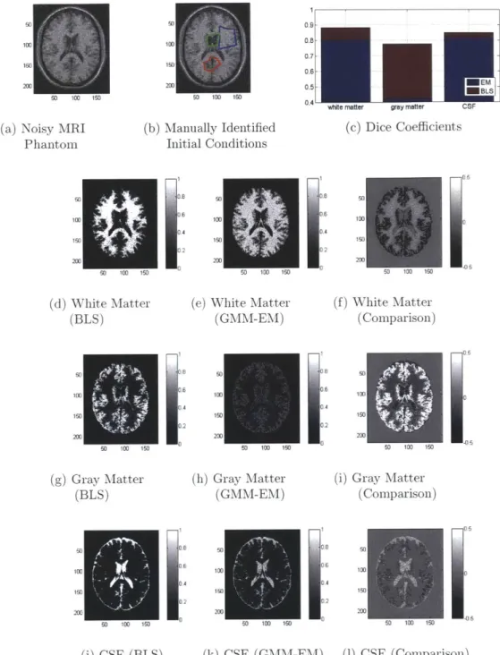 Figure  3-5:  Comparison of  BLS  and FMM-EM for  MRI  phantom  segmentation.  (a)  MRI  phan- phan-tom  with  SNIR,  2.8340  dB:  (b)  manual  reference  patches:  white  matter  (blue),  gray  matter  (red), cerebrospinal  fluid  (CSF,  green);  (c)  Dic