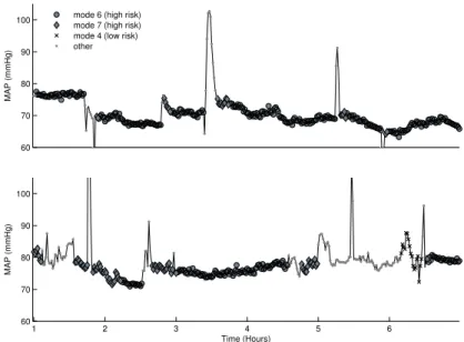 Figure 1.5 Example mean arterial blood pressure of four patients sampled during the first 24-hours in the ICU