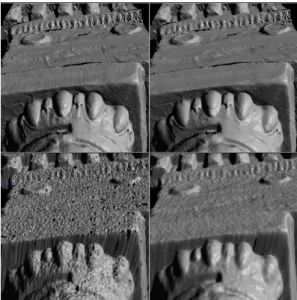 Fig. 1. The Erechtheion with team members using the medium-range laser scanner.