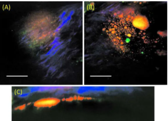 Fig. 3 Epi-NLO images of an advanced plaque obtained at 共a兲