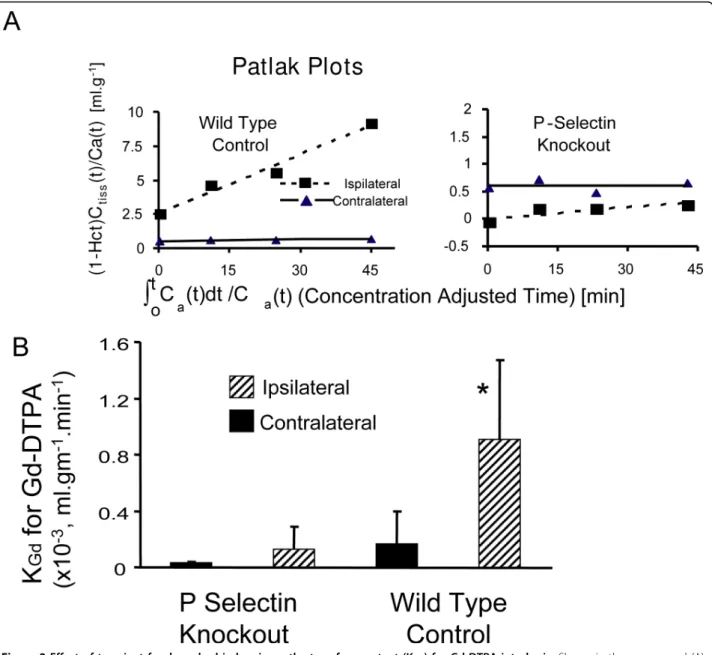 Figure 2 Effect of transient focal cerebral ischemia on the transfer constant (K Gd ) for Gd-DTPA into brain