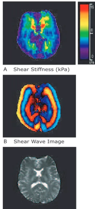 Figure 3C shows an MRI scout image of the fruit pudding.