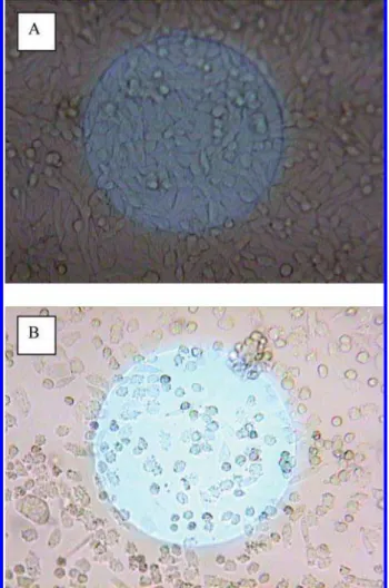 FIGURE 4. Microscopic photos of CHO cells on the laminin coated gold electrode surface after 24 h: (a) without  cylindro-spermopsin and (b) 6.6 µg/mL cylindrospermopsin
