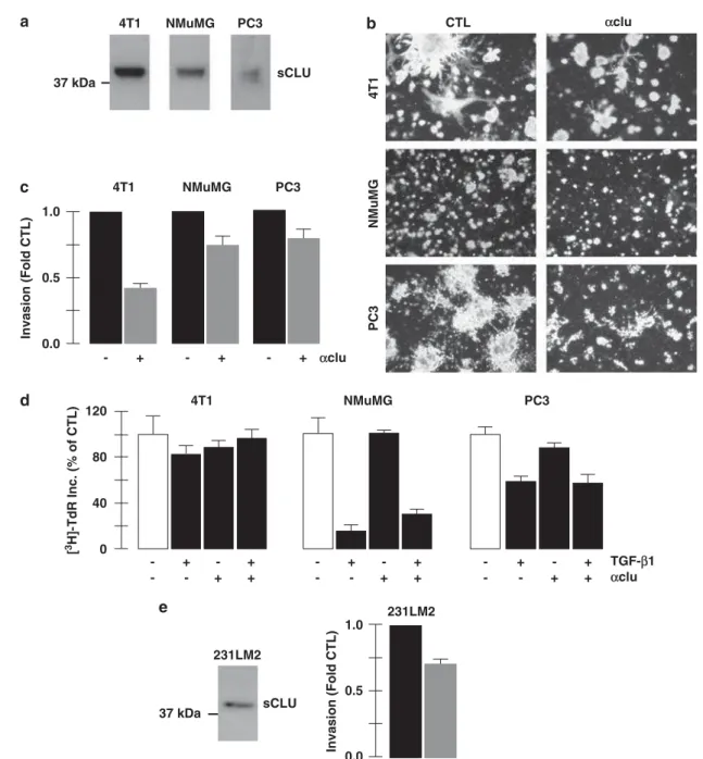 Figure 6 Clusterin polyclonal IgG inhibits the invasive behavior of cell lines other than the BRI-JM01 cell line