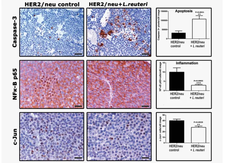 Figure 6. Feeding of L. reuteri increases apoptosis and suppresses anti-apoptotic signals in HER2/neu mammary tumors