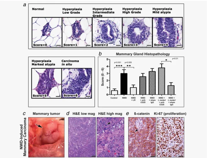 Figure 2. Westernized diet-induced mammary carcinogenesis in Swiss mice. (a) Progression of diet-associated hyperplastic and early neo- neo-plastic lesions in the mammary glands of 5-months-old Swiss mice