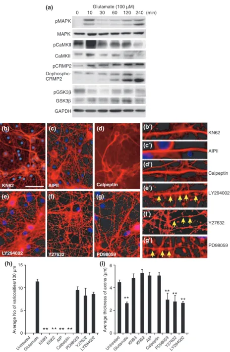 Fig. 2 CaMKII inhibitors protected axons from glutamate toxicity. Cultured cortical neurons were treated with 100 lM  gluta-mate for 10, 30, 60, 120 or 240 min