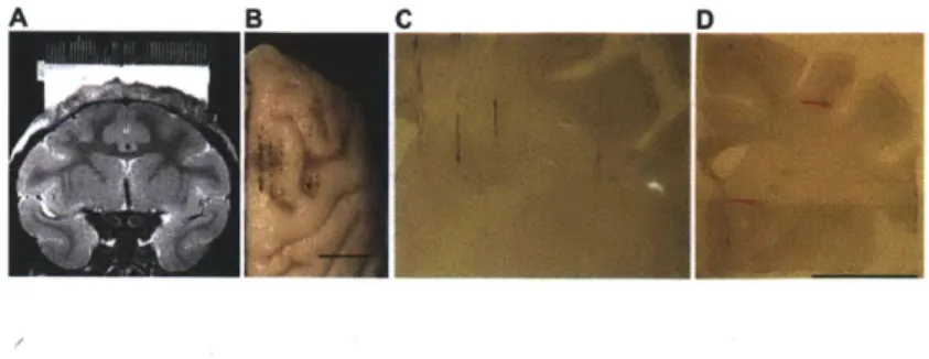 Figure  2 - Graybiel