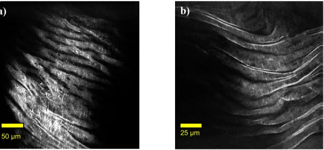 Figure 6: Representative TPEF images showing structure of internal elastic lamina of arterial samples a) acquired using the  fiber-coupled configuration b) acquired using the free-space microscopic configuration for epi-detection  