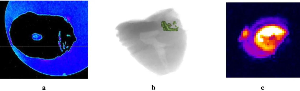 Fig.  2.  Cross-section  of  a  3D  SE  MR  image  (a)  and  the  pseudo  3D  reconstruction  (b)  of  water  in  the  porous  tissue of a decayed tooth, obtained from 3D SE MR data