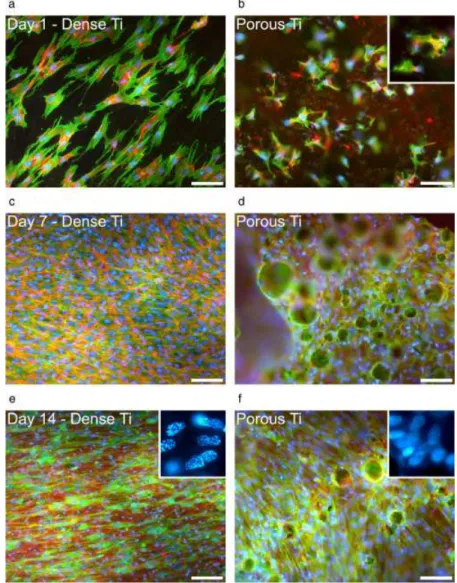Fig. 2. Fluorescence labelling of osteogenic cells derived from human alveolar bone cultured on dense titanium (Ti) surface (a, c, and e) and porous Ti structure (b, d, and f) at days 1 (a and b), 7 (c and d), and 14 (e and f)