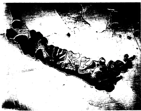 Fig.  13 - Particle  in  the  nickel-titanium  binary  sample melted  with  a  graphite  electrode;  the  dark phase in  the  center  is  the  "pink" structure