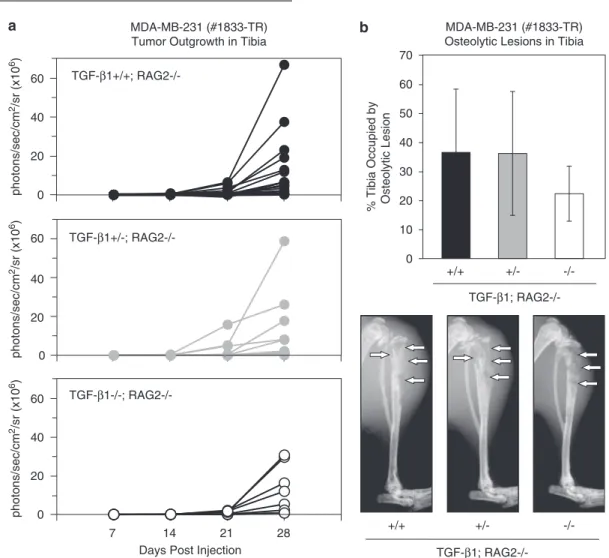 Figure 4 Established osteolytic lesions grow at similar rates in transforming growth factor (TGF)-b1 þ / þ ; RAG2/, TGF-b1 þ /;