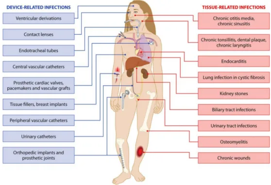 Figure 9. Reported sites of device-related and tissue infections. Reprinted with permission [134]