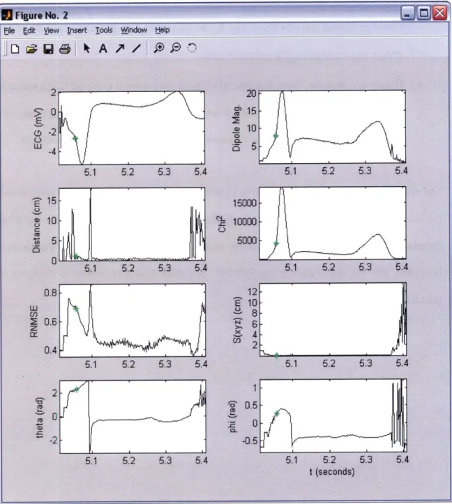 Figure 5.12:  Trend  Plot displaying  the trends in  eight dipole  parameters