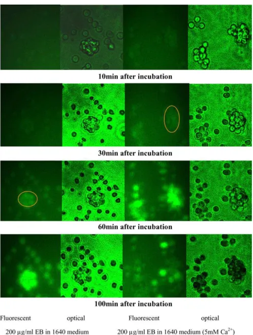 Fig. 2. The typical photos of Jurkat T lymphocyte cells under toxin EB (200 l g/ml) with 0.42 mM and 5 mM Ca 2+ in 1 ml culture medium at different cultured time