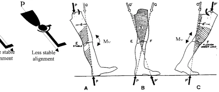 Figure  Four-  Stability in  the  alignment of  a prosthesis.  In A, the  leg  is  in  the  position  it  would be  at  heel  strike  (initial loading)  