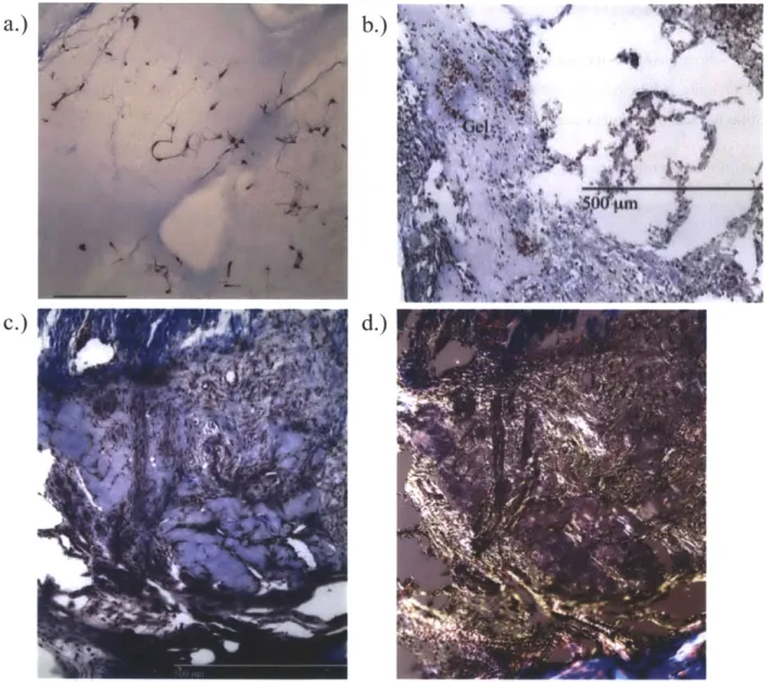 Figure 5-3:  Appearance  of the Col-Gen  gel  in  Masson's  trichrome  stained  paraffin  sections  a.) In vitro containing  primary  astrocytes