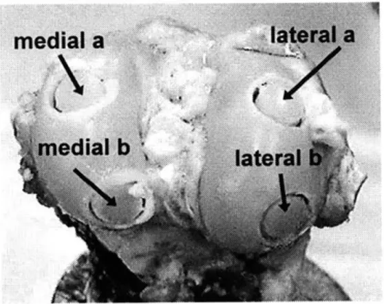 Figure  3.  Sheep  knee with  cores medial  b  (LMb),  left lateral  a  (LLa),  left lateral