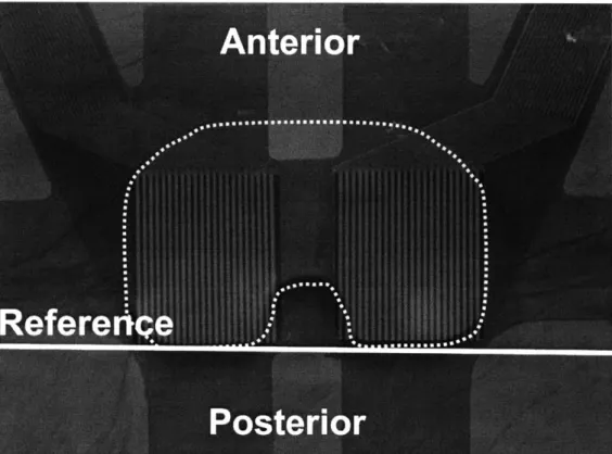 Figure  20:  The  position of the  TekScan*  film over the polyethylene  liner.