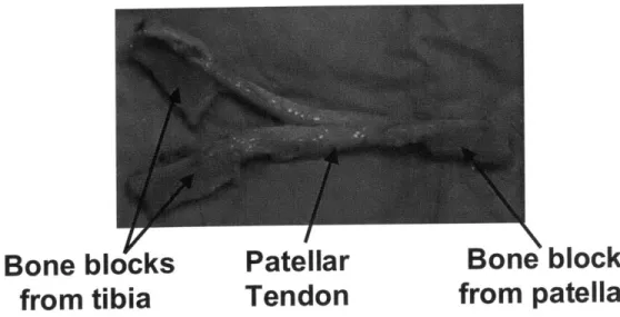Figure  3.2)  (Dennis  et  al,  2004;  Kitamura  et  al,  2003).  These  materials  are  used  in  a number  of different  reconstruction  techniques.