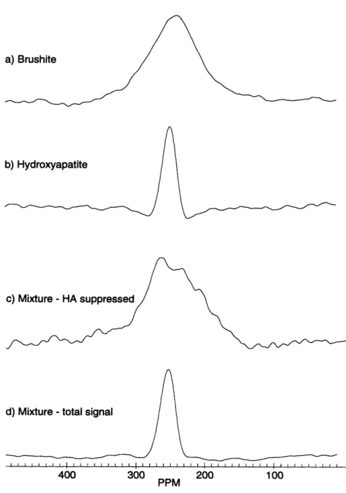 Figure  3-4:  (a)  ADRF-CP  spectrum  of brushite;  (b)  ADRF-CP  spectrum  of synthetic hydroxyapatite;  (c)  ADRF-CP spectrum  of a mixture of 90%  hydroxyapatite  and  10%