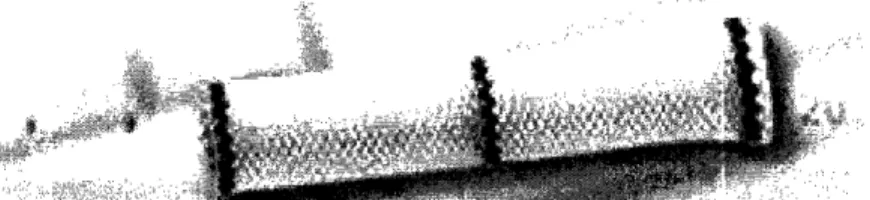 Figure 11  Riisch Polyflex  is a non-biodegradable  polymer  esophageal  stent [22]