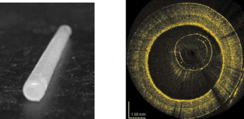 Fig. 3. Cylindrical shaped multilayer phantom, 3 mm of internal diameter, that mimics the geometry and the optical  properties of a coronary artery (left) and the corresponding OCT image obtained with IMI’s OCT intravascular  imaging system (right)