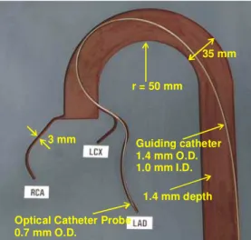Fig. 6. Coronary artery 2D model developed at IMI for NURD testing. The aorta, the right coronary artery (RCA), the left  anterior descending artery (LAD) and the left circumflex artery (LCx) are grooved in the plate