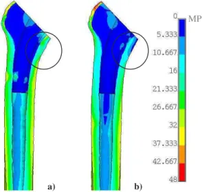 Figure 2: Micromotions at bone-implant interface in HA- HA-coated proximal part of stem for stair climbing load case 
