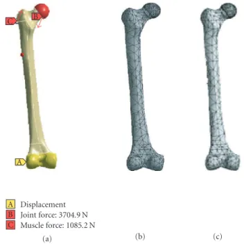 Figure 1: Hip resurfacing. (a) Hybrid HR and (b) Birmingham HR.