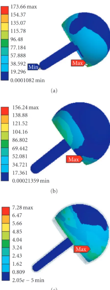 Figure 5: Von Mises stress in the cancellous bone using (a) BHR implant and (b) HHR.