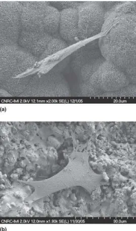 Fig. 1 Typical surface morphology for (a) HA coatings and (b) nano- nano-TiO 2 coatings