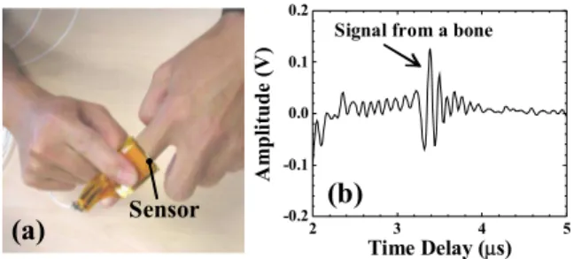 Figure 5.  Ultrasonic signal from a bone at a finger using the  membrane sensor in a  pulse-echo technique: (a) experimental 