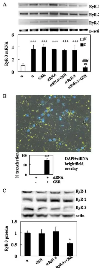 FIGURE 3. Levels of RyR-3 mRNA and protein are decreased in TgCRND8 neurons after treatment with siRNA.A, representative agarose gel showing fold changes of RyR-1, RyR-2, and RyR-3 RT-PCR products from non-Tg (N) and TgCRND8 (T) 8.0 ⫻ 10 5 primary cortical