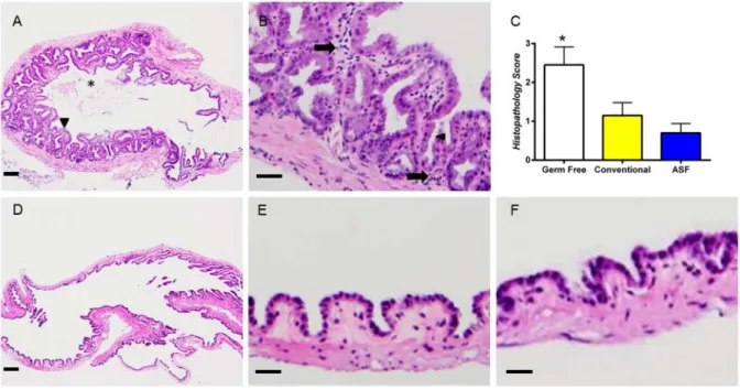 Figure 8. Germ-free mice develop significantly more severe gallbladder histopathological changes compared to ASF colonized mice