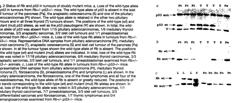 Fig. 2 Status of Rb  and p53 in tumours of doubly  mutant  mice. a, Loss of the wild-type  allele of p53 in tumours from Rb+/-:p53+/-  mice