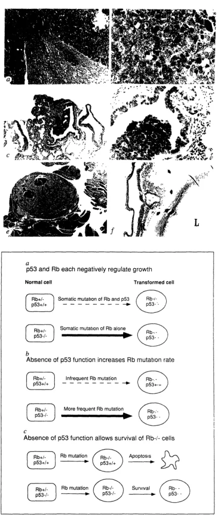 Fig.  3 Novel pathology  present in Rb +/-; p53 -/-  animals.
