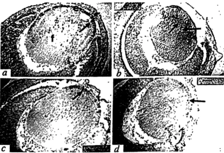 FIG.  4  Apoptotic  cell  death  in lenses from  E13.5  wild-type  and  mutant embryos