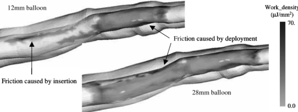 Figure 5: Predicted friction work density on the arterial wall for the 12 mm and the 28 mm balloons
