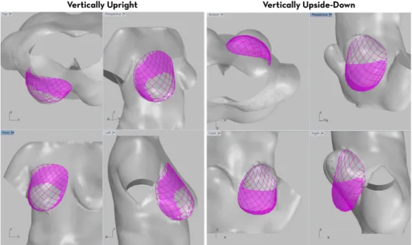 Figure 9. Renderings showing breast simulated at vertical extremes.