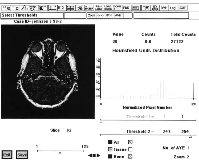 Figure 2.7 Screen