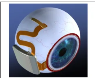 Figure 5.   Hermetic retinal prosthesis and associated primary power and data  coils.  The device on the left is a prototype of the device in Fig