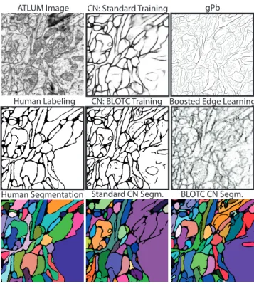 Figure 2. Visual comparison of output from a convolutional nework (CN) trained in the standard way and a convolutional  net-work trained with BLOTC, on an image from the test set