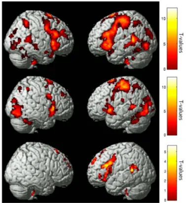 Figure 1. Sentence presentation rate differentially impacts brain activation by group