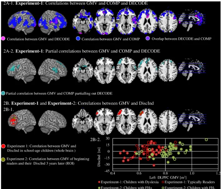 Fig 2. The neural correlates of decoding, reading comprehension and DiscInd. A. Experiment-1